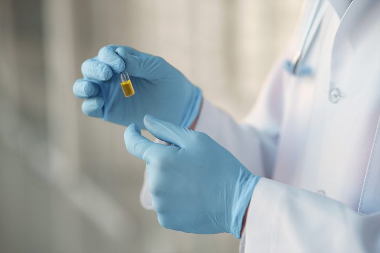 Nuevo método desarrollado en Israel para combatir el cáncer de hígado con CBD
